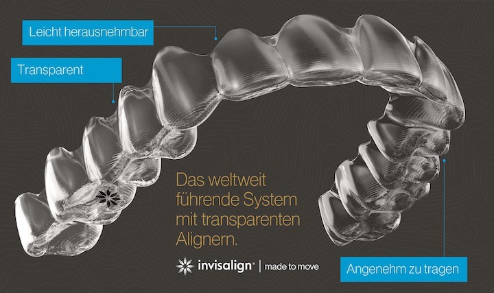 Invisalign Schiene Infografik zu den transparenten Alignern "invisalign"